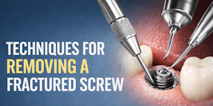 Techniques for Removing a Fractured Screw