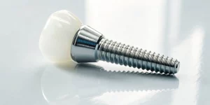 The three components of a modern dental implant: the implant screw, abutment, and crown.