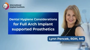 Dental Hygiene Considerations for Full Arch Implant supported Prosthetics Thumbnail